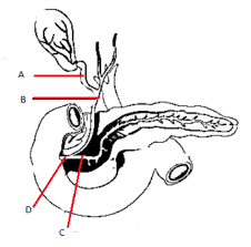 Prolonged alcholic intake drugs, chemicals viral hepatitis. The Given Diagram Shows A Duct System Of Liver Gallbladder Class 11 Biology Cbse