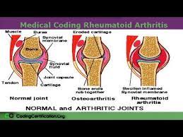 Medical abbreviations beginning with … How To Code Rheumatoid Arthritis Medical Coding Tips Youtube