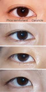 As the child grows, the nose bridge increases in height and the appearance of fold simply disappears for those not genetically inclined toward this eye appearance. Update On Asian Eyelid Anatomy And Periocular Aging Change Springerlink