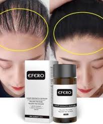 Hair Growth Essence Oil In 2020 Hair Loss Essential Oils Hair Growth Serum Fast Hair Growth Oil