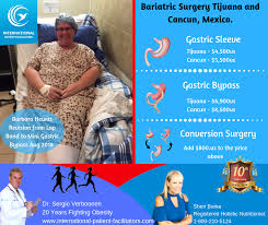 Pin On Weight Loss Surgery Mexico