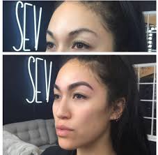 At sev we combine the best of both worlds: Sev Laser Aesthetics On Twitter Before After Steph Shep Eyebrows By Ibrowsbyeb Sevlaseraesthetics Melroseplace Eyebrowshaping Https T Co Ythbaowbru Twitter