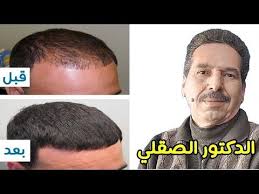وصفة الدكتور جمال الصقلي للتخلص من تساقط الشعر نهائيا في اسبوع وصفة كالمعجزة رخيصة وبمكونات قليلة ومجربة موقع يا لالة Youtube Wedding Decorations Wedding