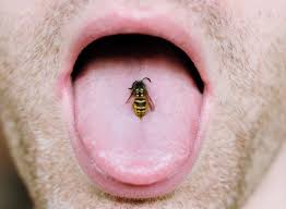 What To Do If You Re Stung By A Yellowjacket