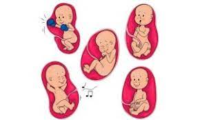 Check spelling or type a new query. 25 Gambar Pembentukan Bayi Dalam Kandungan Setelah 12 Tahun Dirakam Menakjubkan