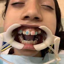 TOP 10 BEST Orthodontists near Upper Township, NJ