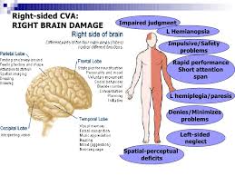 neurological system includes stroke