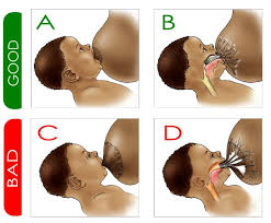 Untuk memperlancar buang air besarnya, anda bisa membuat bayi berbaring ditempat tidur dengan nyaman, kemudian pegang kedua pergelangan kakinya secara. Kerap Menangis Tanda Bayi Kembung Perut Ini 8 Tips Mengatasinya