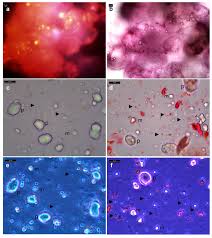 Maybe you would like to learn more about one of these? Microorganisms Free Full Text Intracellular Bacteria In Plants Elucidation Of Abundant And Diverse Cytoplasmic Bacteria In Healthy Plant Cells Using In Vitro Cell And Callus Cultures