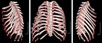 It connects to the ribs via cartilage and forms the front of the rib cage, thus helping. Thoracic Cavity An Overview Sciencedirect Topics