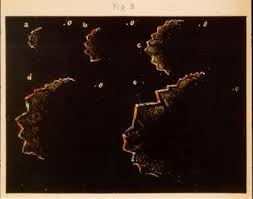 Résultat de recherche d'images pour "Migraine auras"