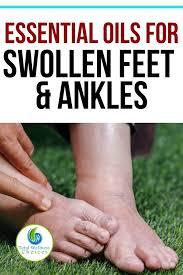 Top 5 Essential Oils For Swollen Feet And Ankles Essential Oil For Swelling Swollen Feet Remedy Foot Remedies