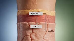 Image result for Dry Skin