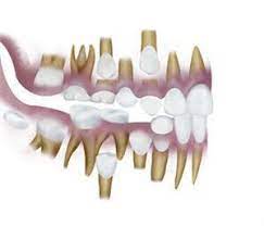 Pin On Pediatric Dentistry