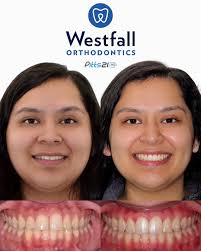 Q and A time with the G.O.A.T.s!🐐 #pitts21 #pitts21pro #pittsprotocols  #gpsméxico