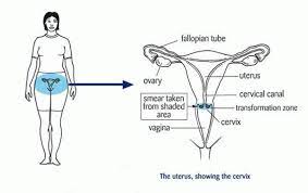 Here's what you should know about early signs, screening guidelines, tips for prevention, and more. About Cervical Cancer Time To Screen National Screening Unit