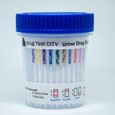 Drug testing is often done when applying for employment, especially for positions that may involve federal transportation, airline industries and pilots, bus drivers, trucker drivers, railways, hospitals, and other workplaces where public safety is of the utmost importance. Which Drug Test Do Most Probation Offices Use Drug Test City