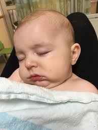 Prayer for baby with breathing issues and strokes