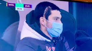 Wolves striker raul jimenez hopes he will be able to return from his head injury. Raul Jimenez S Shocking Scar After His Head Injury Marca