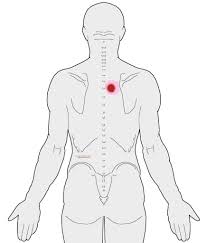 Pin On Back Pain