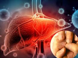 Top 7 Symptoms of Liver Disease in Women You Shouldn&#039;t Ignore |  TheHealthSite.com