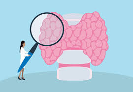 Use a handheld mirror to look at the lower front area of. Thyroid Disease May Run In Your Family And You Might Not Know It Health Essentials From Cleveland Clinic