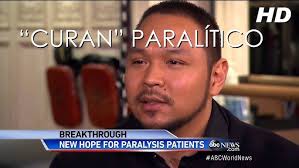 Paralítico vuelve a caminar gracias a un implante eléctrico