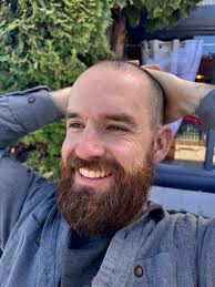 Who can put blinker lights