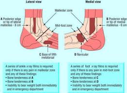 It was bad for like the first week then it was ok but the pain still has not gone away. Ankle And Foot Injuries Musculoskeletal Flashcards Quizlet