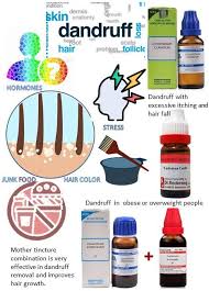 Initially setup with an objective to make available quality products to every nook and corner of. How To Get Rid Of Dandruff With Natural Remedies In 2021 Homeopathy Medicine Alternative Medicine Homeopathy Homeopathy