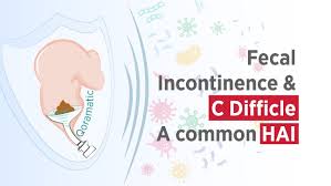 Image result for Fecal Incontinence