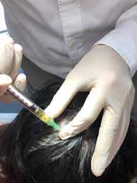 Students can apply directly through the university website. Platelet Rich Plasma Prp Peter Ch Ng Skin Specialist Kl Malaysia