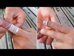 Video Mida Teha Kui Laps On Mutri Enda Sorme Pannud Ja Ei Saa Seda Enam Sealt Katte Ring Stuck On Finger Simple Tricks Finger
