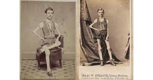 Iată un top 25 cu cele mai avute persoane ale planetei. Cum AratÄƒ Cel Mai Slab Om Din Lume Intreaga ViaÅ£Äƒ A CantÄƒrit Doar 18 Kilograme Nu S A Mai IngrÄƒÈ™at De La 12 Ani