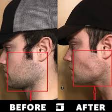 We did not find results for: Mewing Club Posts Facebook