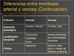 Causas de solfa syllable trombosis through. Ppt Diatesis Trombotica Powerpoint Presentation Free Download Id 7022902