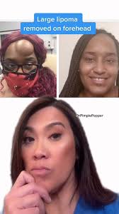 I ❤️ my job... , What have you been to the dermatologist for and how did it  go?, ✌️❤️💥 #drpimplepopper #popaholics #dermatology #medicaleducation