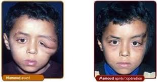 Dr Gérald Franchi MD