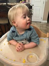 This child, with an extra chromosome, is valuable and worthy of life. Do  you agree?