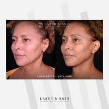 Plastic surgery complements the dermatologic services we provide and our  plastic surgeons work closely with our board-certified dermatologists for  optimal coordinated care. Our plastic surgeons have the knowledge,  experience, and expertise to