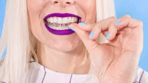 Do it yourself braces commercial. Is Smiledirectclub Safe Teeth Straightening Service Slams Nbc Report