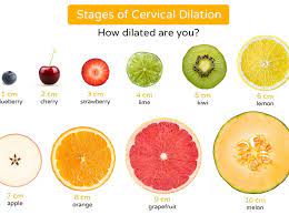 Cervical Dilation What It Is And How Long It Takes Madeformums