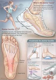 Plantar Fasciitis The More You Know Post In 2020 Plantar Fasciitis Exercises Plantar Fasciitis Treatment Plantar Fasciitis