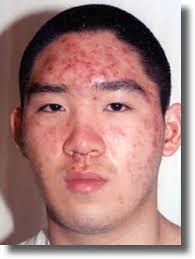 Before and After Pictures