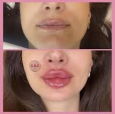 43 Lips ideas