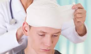 Epidural Hematoma: Gejala, Penyebab, dan Pengobatan