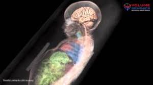 Rosalia was born on december 13, 1918 and died on december 6, 1920 of pneumonia. Rosalia Lombardo Child Mummy 2010 Youtube