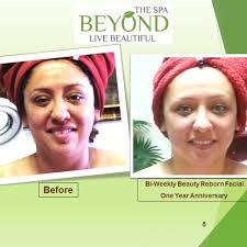 TOP 10 Best ANTI AGING FACIAL in San Jose, CA