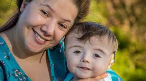 Surgeons remodel skulls of boys born with rare disorder