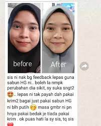 Bukti sabun ini sangat berkesan! Honey Glow Beauty Whitening Soap